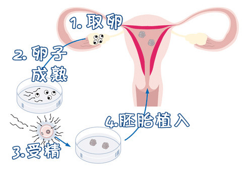关于素竹生殖